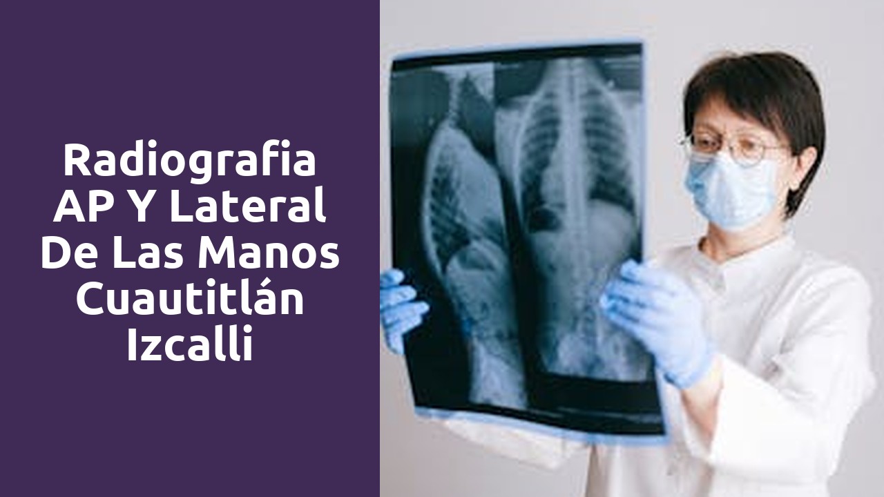 Radiografia AP y Lateral de las Manos Cuautitlán Izcalli